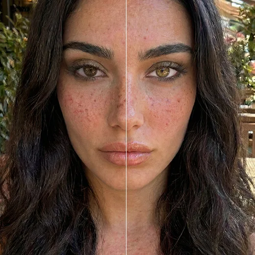 Split before-and-after close-up of a freckled woman with one brown eye and one hazel eye